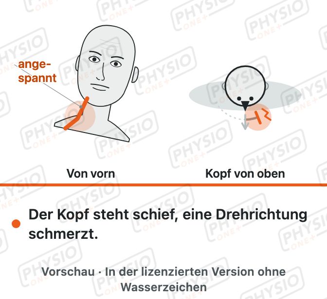 Vorschau: Akut steifer Nacken