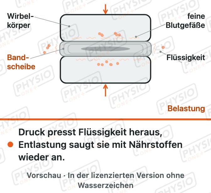 Vorschau: Die Bandscheibe lebt von Bewegung