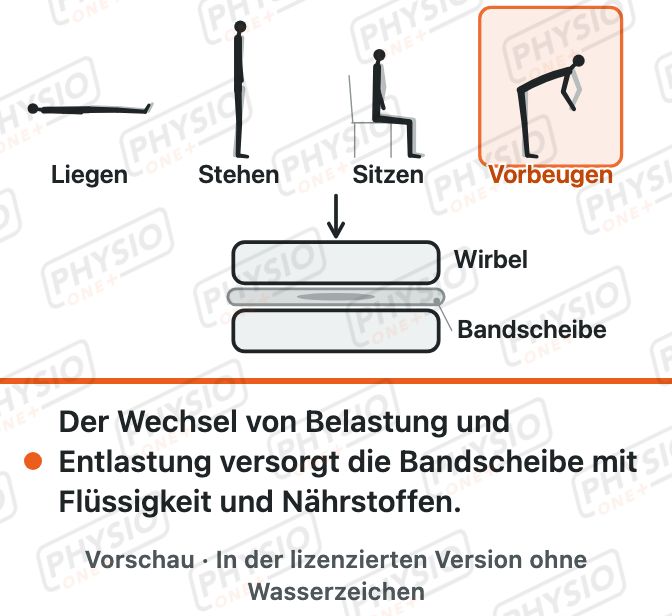 Vorschau: Bandscheibe unter Belastung