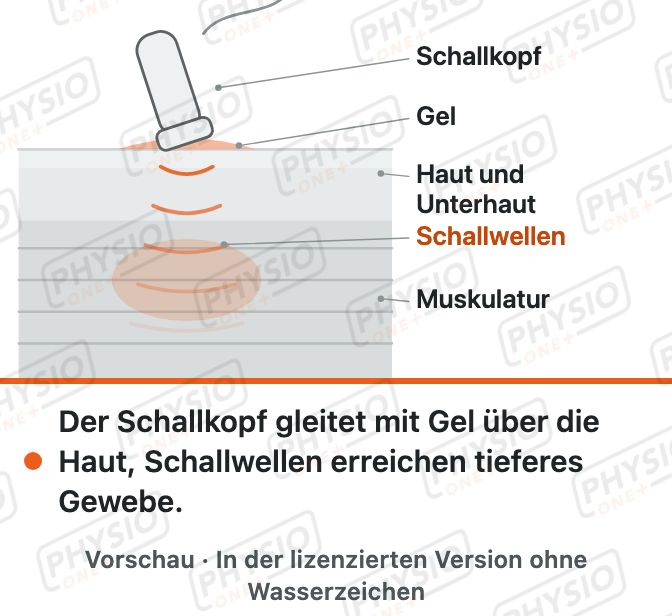 Vorschau: Ultraschalltherapie