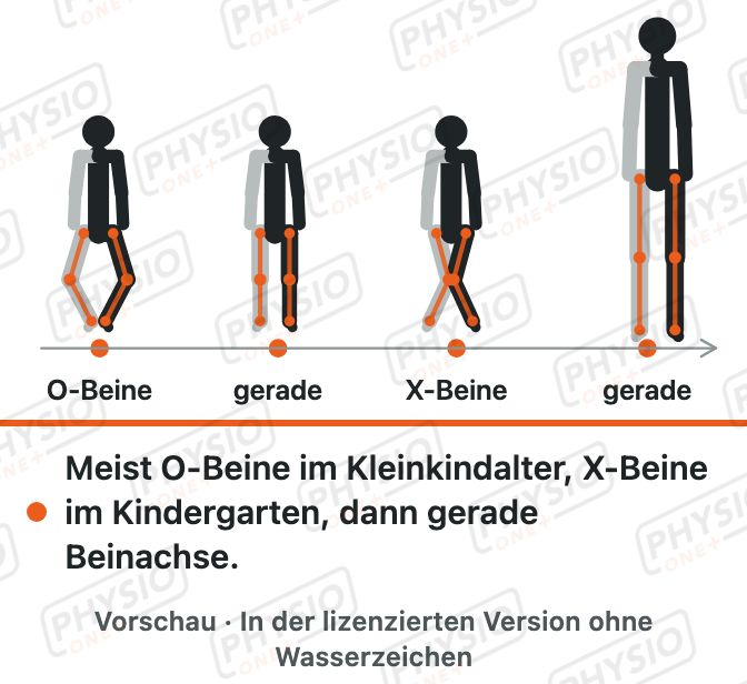 Vorschau: Beinachsen im Wachstum
