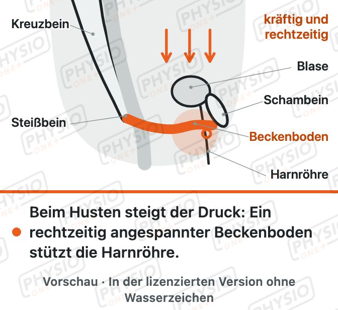 Vorschau: Belastungsinkontinenz