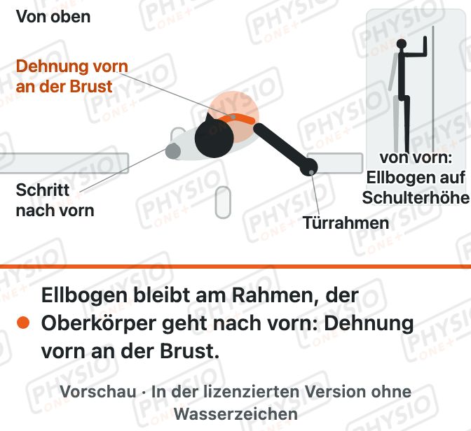 Vorschau: Brustmuskel-Dehnung im Türrahmen