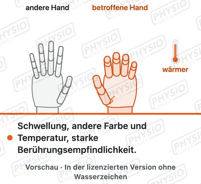 Vorschau: Komplexes regionales Schmerzsyndrom