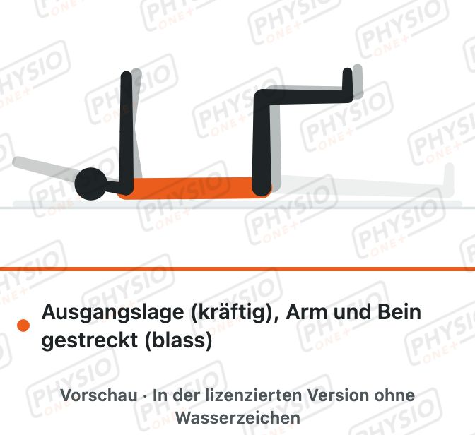 Vorschau: Arm und Bein strecken in Rückenlage (Dead Bug)