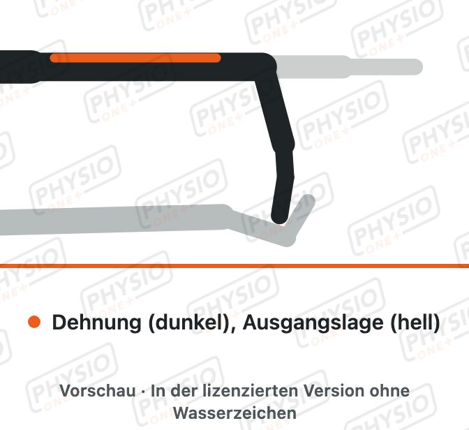 Vorschau: Dehnung der Unterarmstrecker