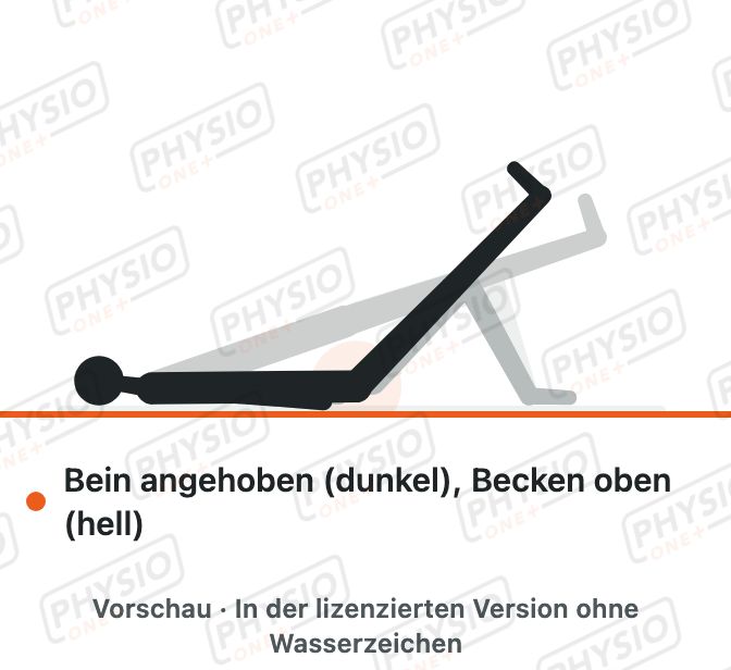 Vorschau: Einbeinige Brücke