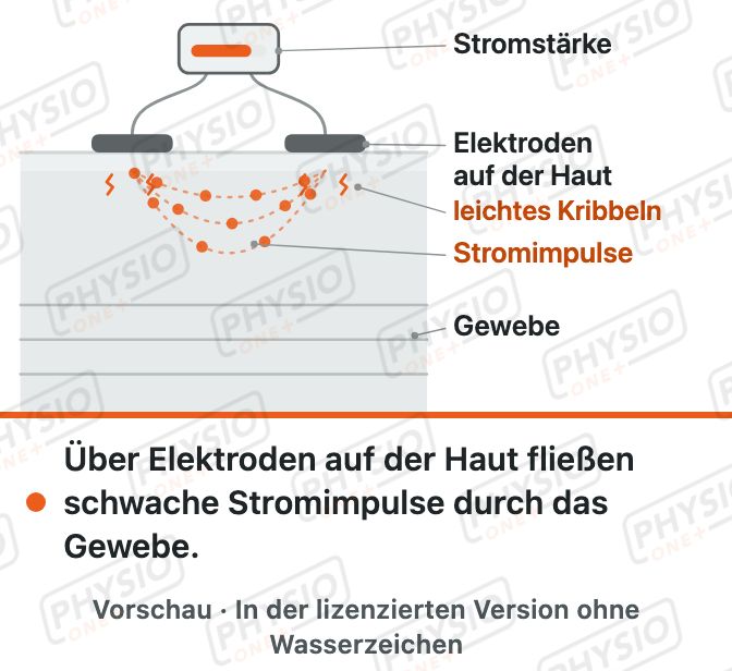 Vorschau: Elektrotherapie