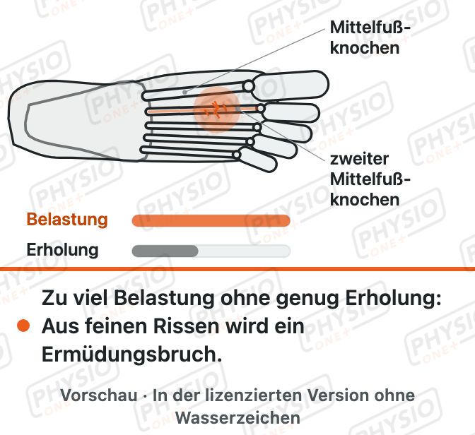 Vorschau: Ermüdungsbruch