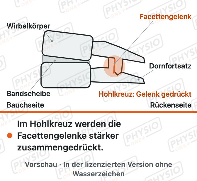 Vorschau: Kleine Wirbelgelenke (Facettengelenke)