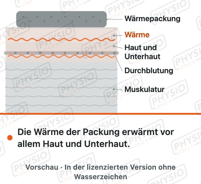 Vorschau: Wärmetherapie mit Fango