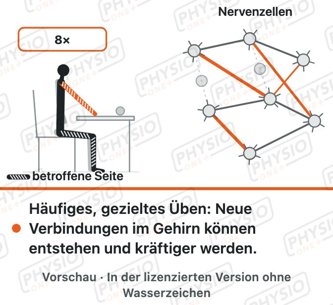 Vorschau: Das Gehirn lernt um: Üben nach Schlaganfall