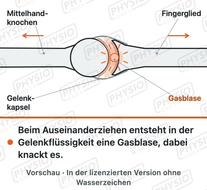 Vorschau: Knacken in den Gelenken