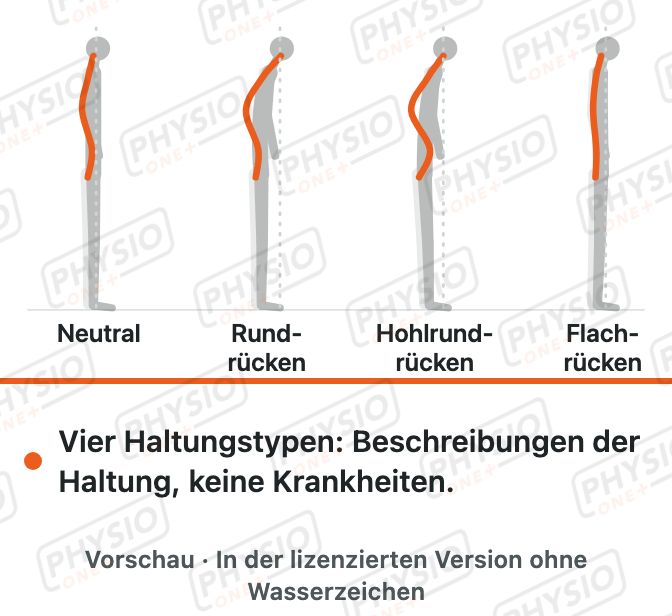 Vorschau: Haltungstypen von der Seite