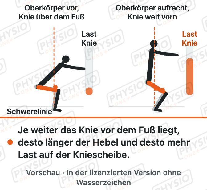 Vorschau: Hebel und Gelenkbelastung