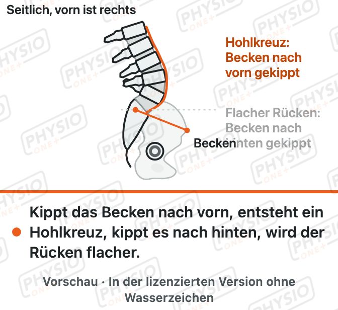 Vorschau: Hohlkreuz und flacher Rücken: Beckenstellung