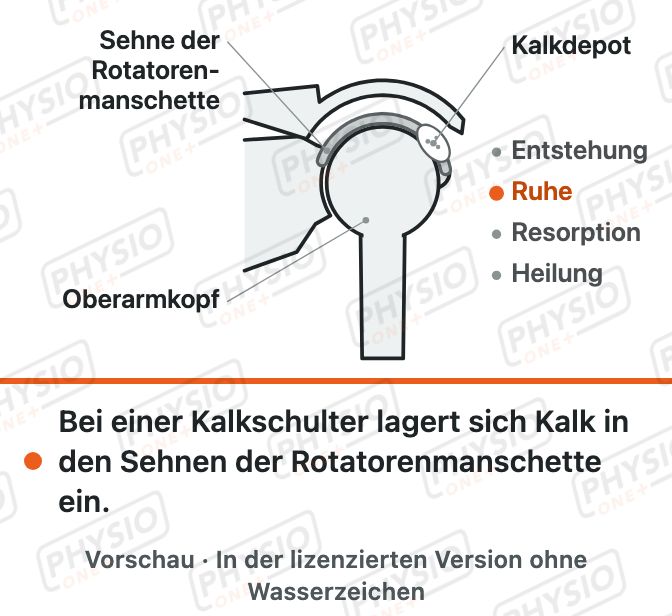 Vorschau: Kalkschulter