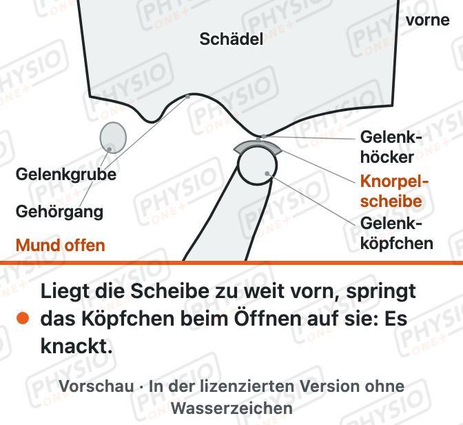 Vorschau: Kiefergelenk bei CMD