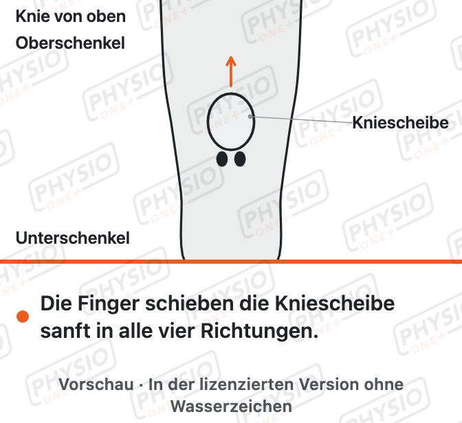 Vorschau: Kniescheibe verschieben