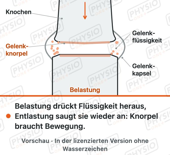 Vorschau: Gelenkknorpel braucht Bewegung