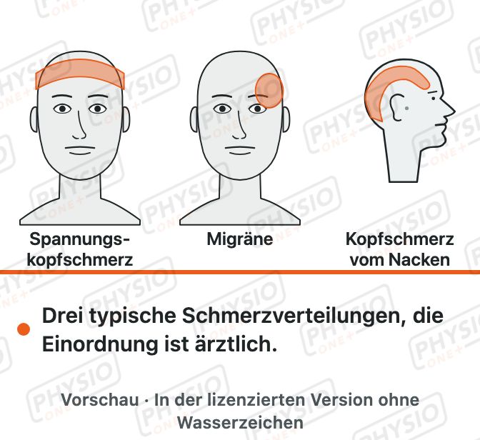 Vorschau: Kopfschmerzarten im Überblick