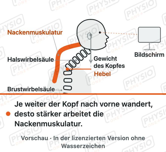 Vorschau: Kopfvorhaltung am Bildschirm