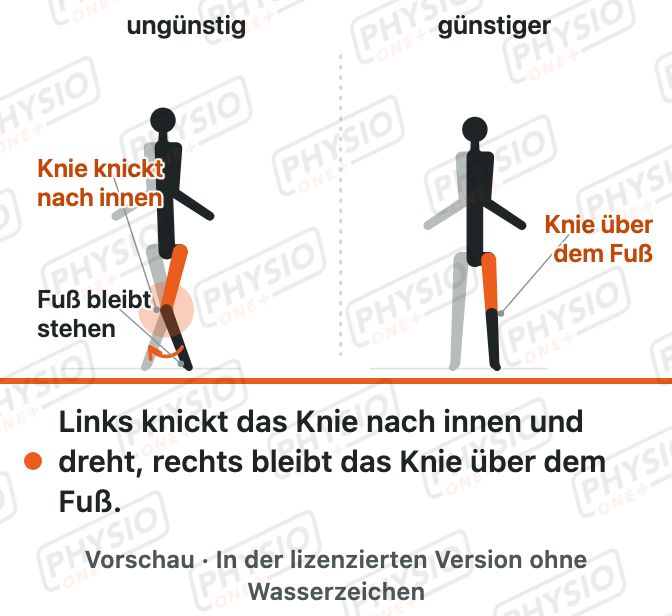 Vorschau: Wie ein Kreuzband reißt