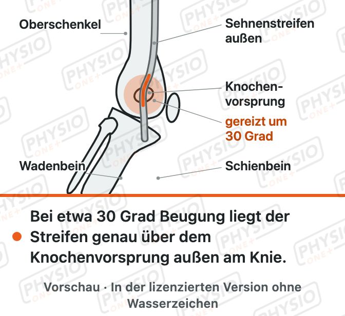 Vorschau: Läuferknie