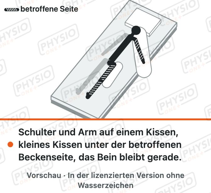 Vorschau: Lagerung in Rückenlage nach Schlaganfall