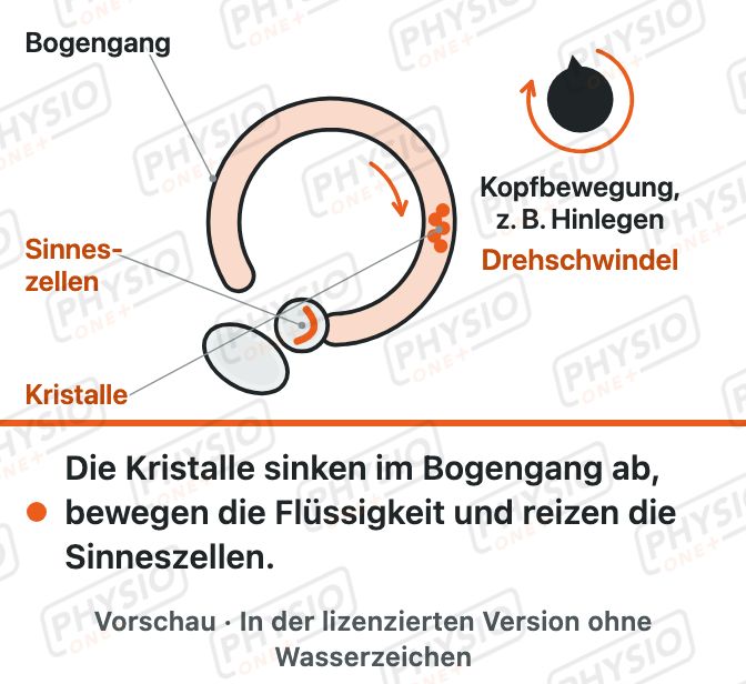 Vorschau: Lagerungsschwindel