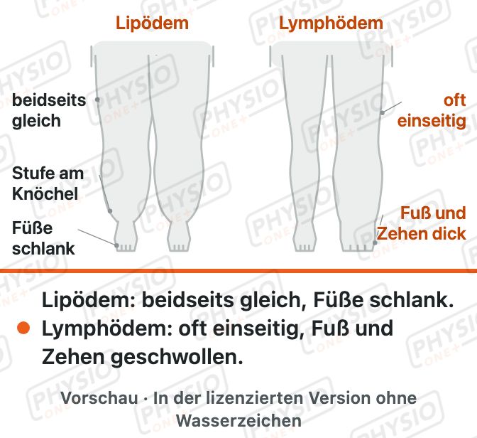 Vorschau: Lipödem und Lymphödem im Vergleich