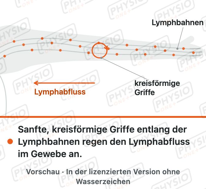 Vorschau: Lymphdrainage im Prinzip