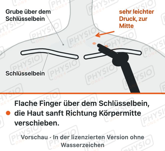 Vorschau: Selbstbehandlung am Schlüsselbein