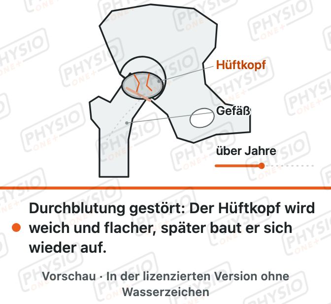 Vorschau: Morbus Perthes