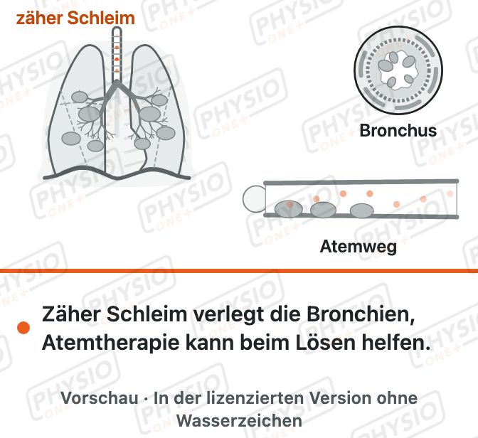 Vorschau: Mukoviszidose
