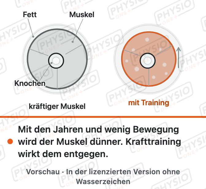 Vorschau: Muskelschwund im Alter