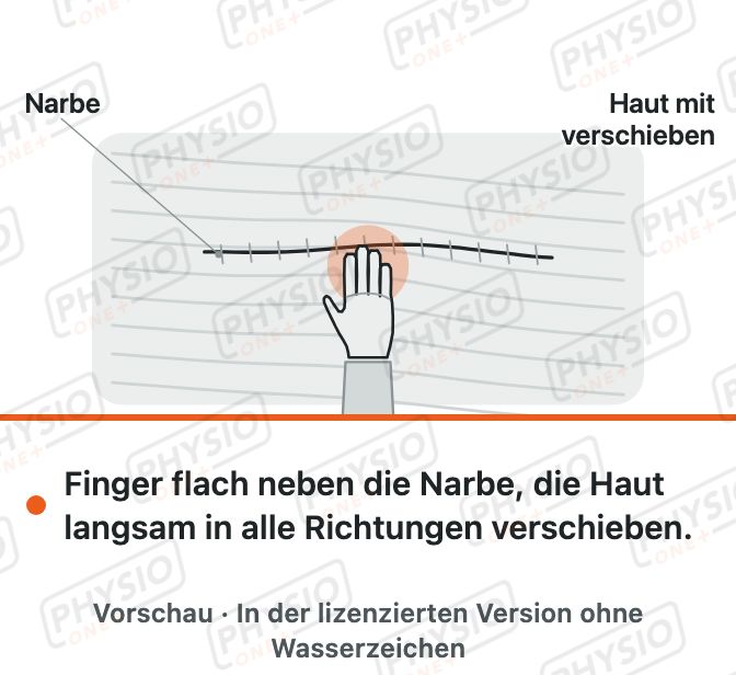 Vorschau: Narbe verschieben