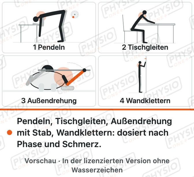 Vorschau: Programm bei Schultersteife (Frozen Shoulder)