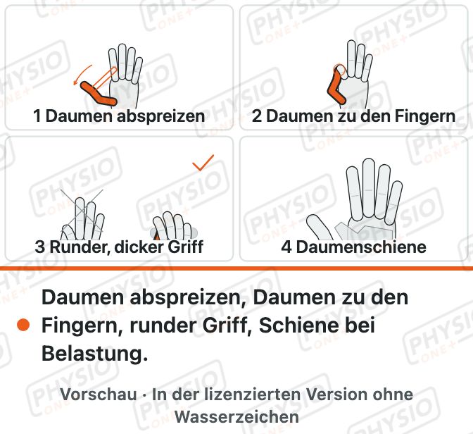 Vorschau: Programm bei Daumensattelgelenkarthrose