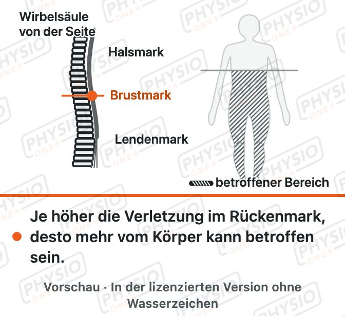 Vorschau: Querschnittlähmung: Grundlagen