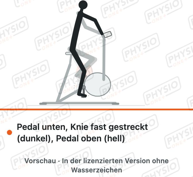 Vorschau: Radfahren auf dem Ergometer nach Knie-OP