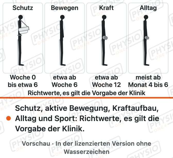 Vorschau: Nach Naht der Rotatorenmanschette: Schutz und Aufbau