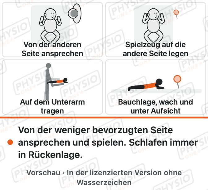 Vorschau: Schiefhals beim Baby: Lagerung und Spiel