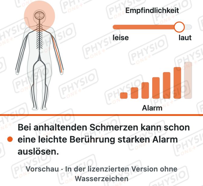 Vorschau: Sensibilisierung: Das Alarmsystem wird empfindlicher