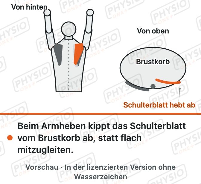 Vorschau: Abstehendes Schulterblatt