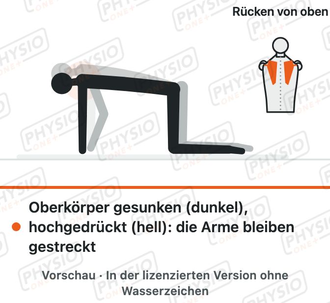 Vorschau: Schulterblattbewegung im Vierfüßlerstand