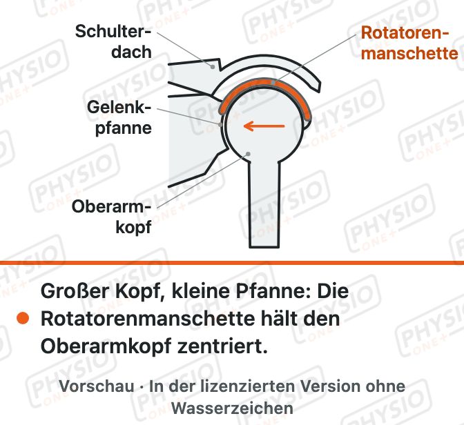 Vorschau: Schultergelenk: großer Kopf, kleine Pfanne