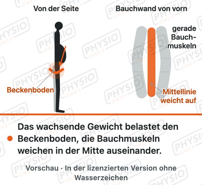 Vorschau: Schwangerschaft: Beckenboden und Bauch
