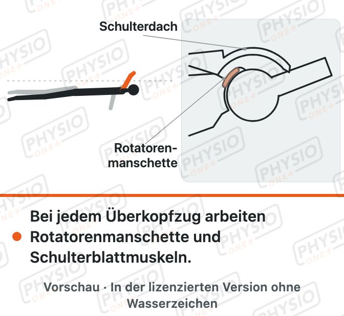 Vorschau: Schwimmerschulter