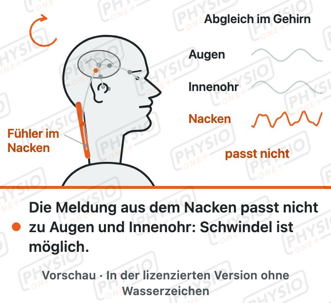 Vorschau: Schwindel aus dem Nacken
